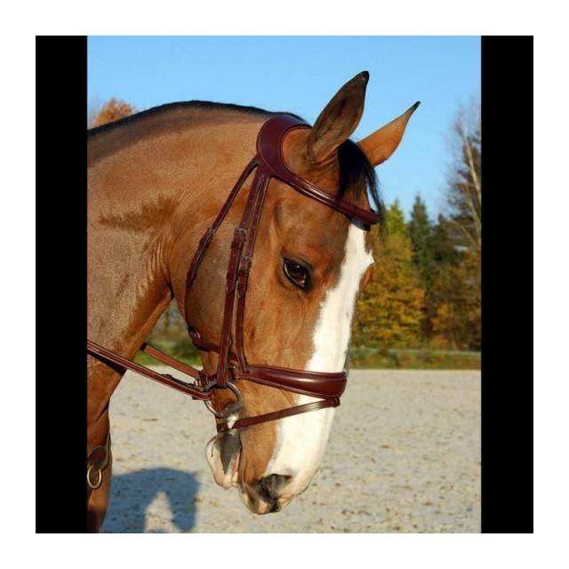 Filet Dyon anatomique